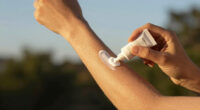 14 Best Sunburn Relief Lotions in 2026