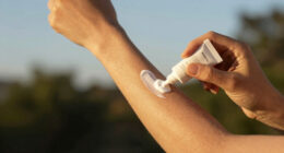 14 Best Sunburn Relief Lotions in 2026